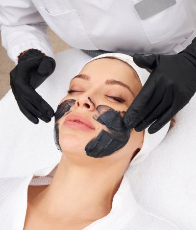 Carbon Peel Facial CARBON PEEL FACIAL in kolkata 1