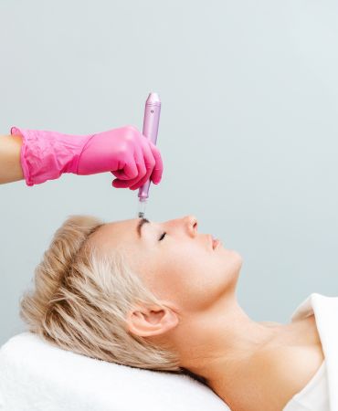 Microneedling MICRONEEDLING by Dr