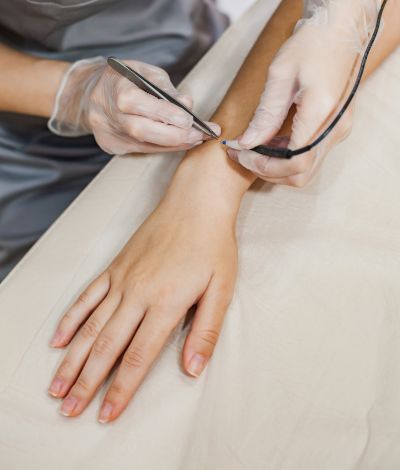 Permanent Hair Removal PERMANENT HAIR TATTOO REMOVAL in kolkata